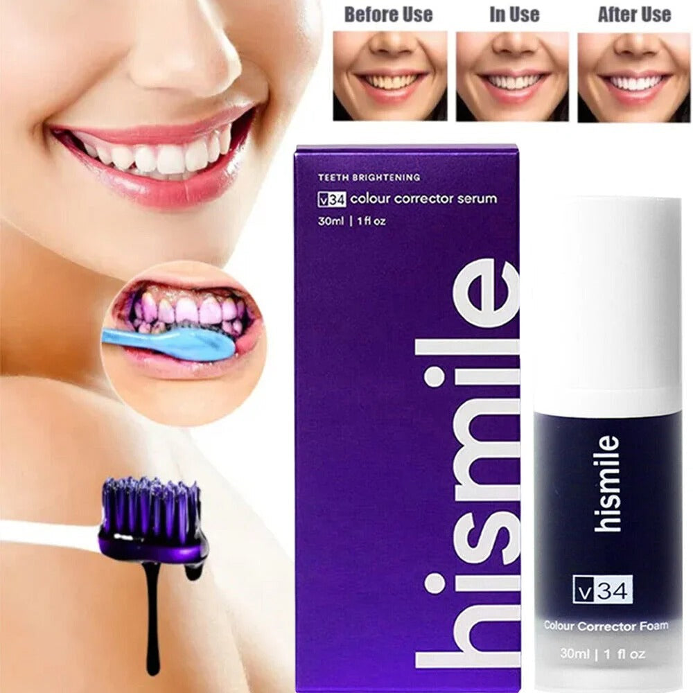 Hismile V34 Tooth Whitening Mousse – Mousse Blanchissante & Correction de Couleur