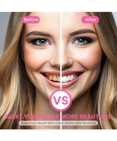 Bodyaccel Toothpaste (Niacinamide Whitening)