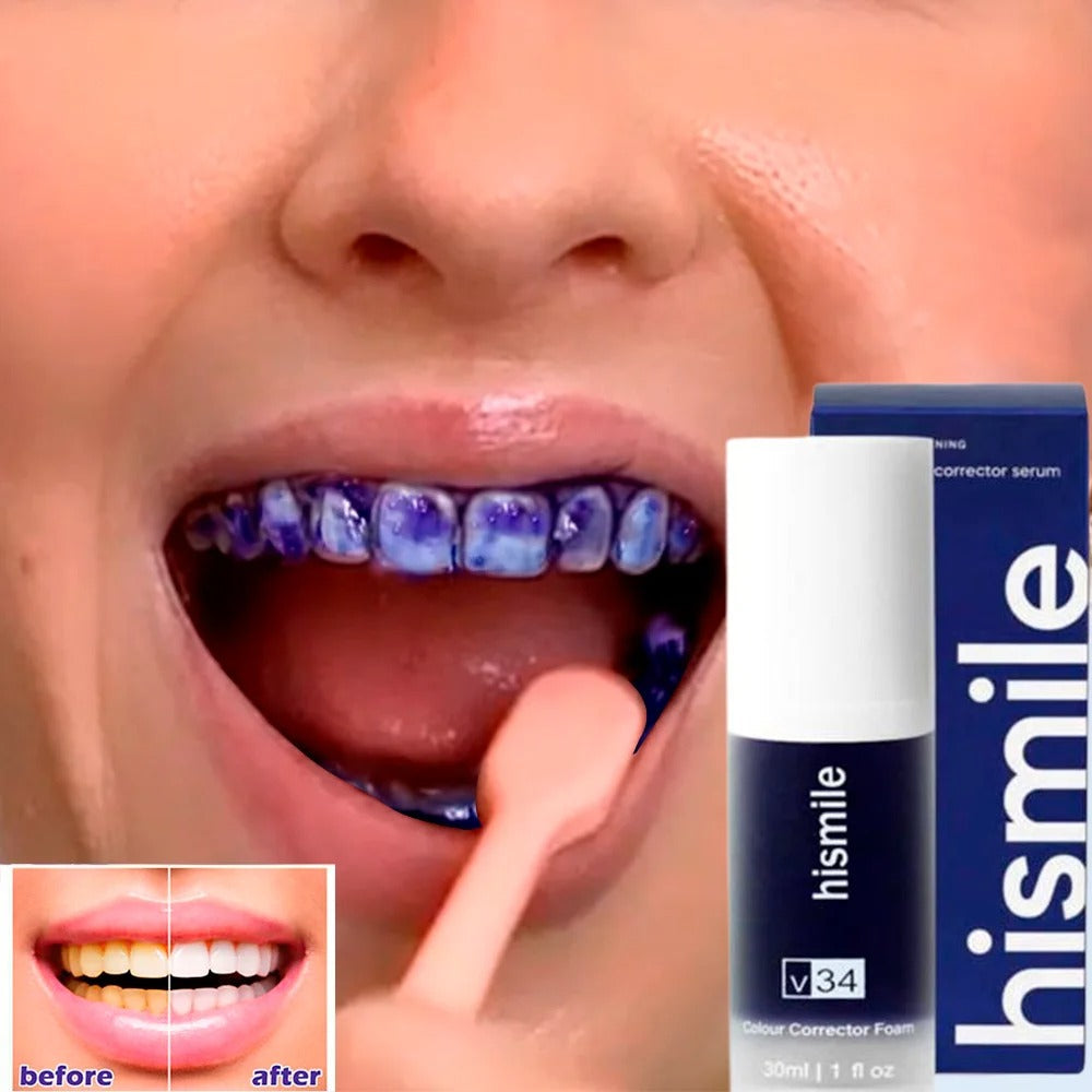 Hismile V34 Tooth Whitening Mousse – Mousse Blanchissante & Correction de Couleur