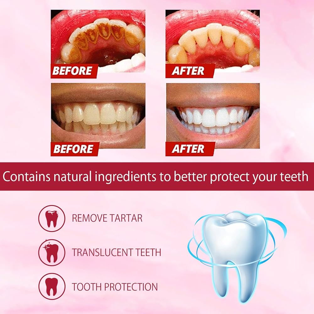 Yayashi SP-4 Ultra + Brightening Probiotic Toothpaste - 120g