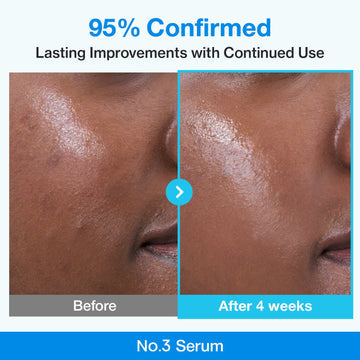 Numbuzin No.3 Blue Bio-Retinol Pore Refining Serum 30ml – Sérum Anti-Pores & Effet Lifting