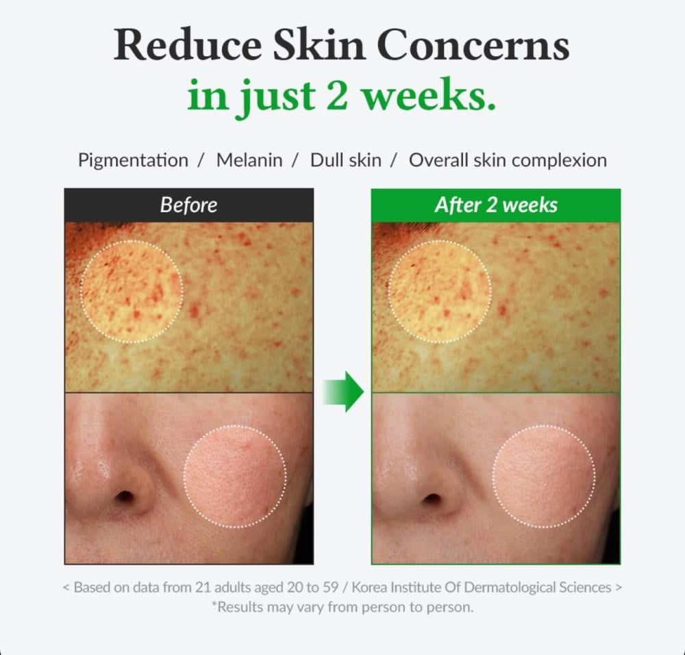 Gentle Vitamin C Serum – Sérum Éclat Débutant & Peaux Sensibles (30 ml)