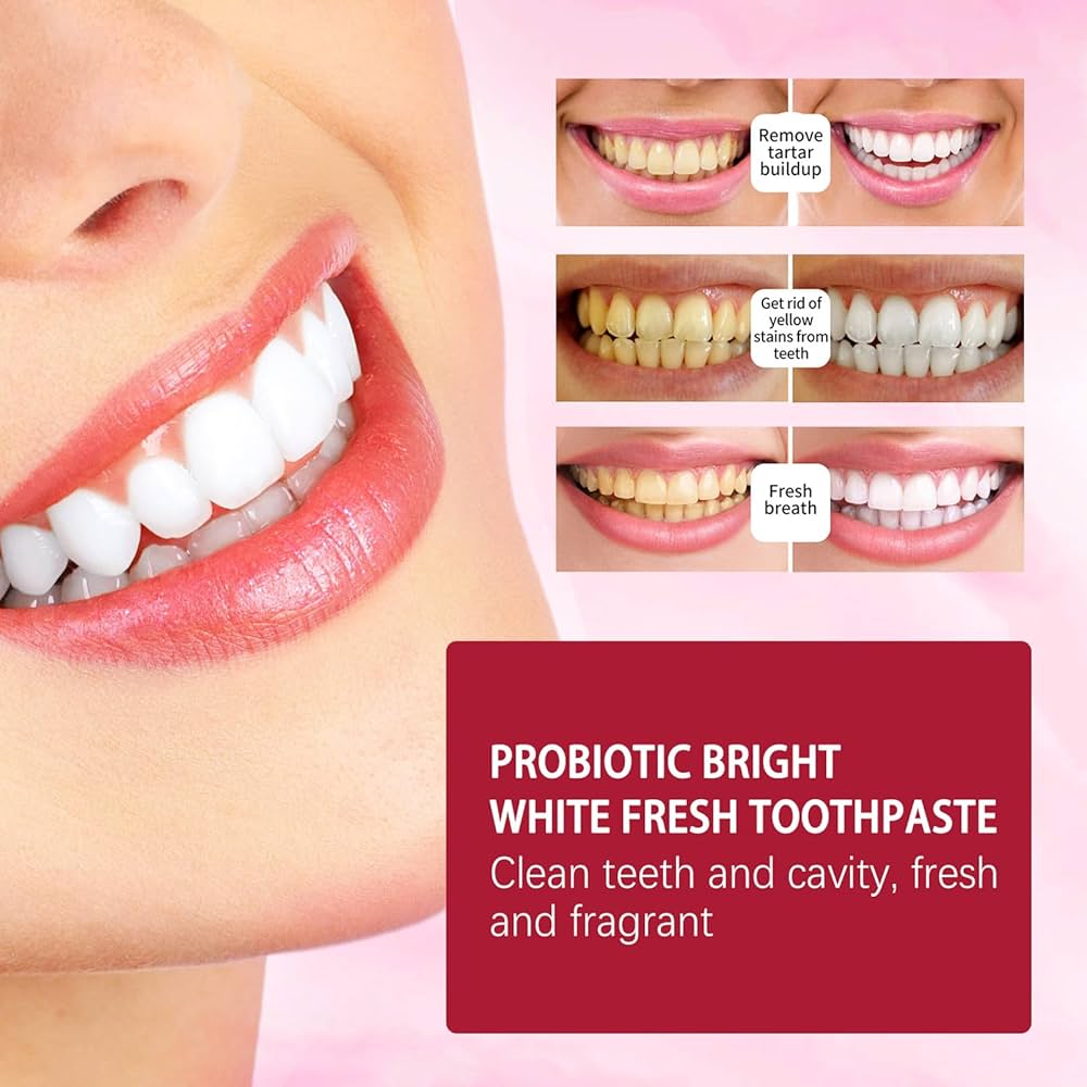 Yayashi SP-4 Ultra + Brightening Probiotic Toothpaste - 120g