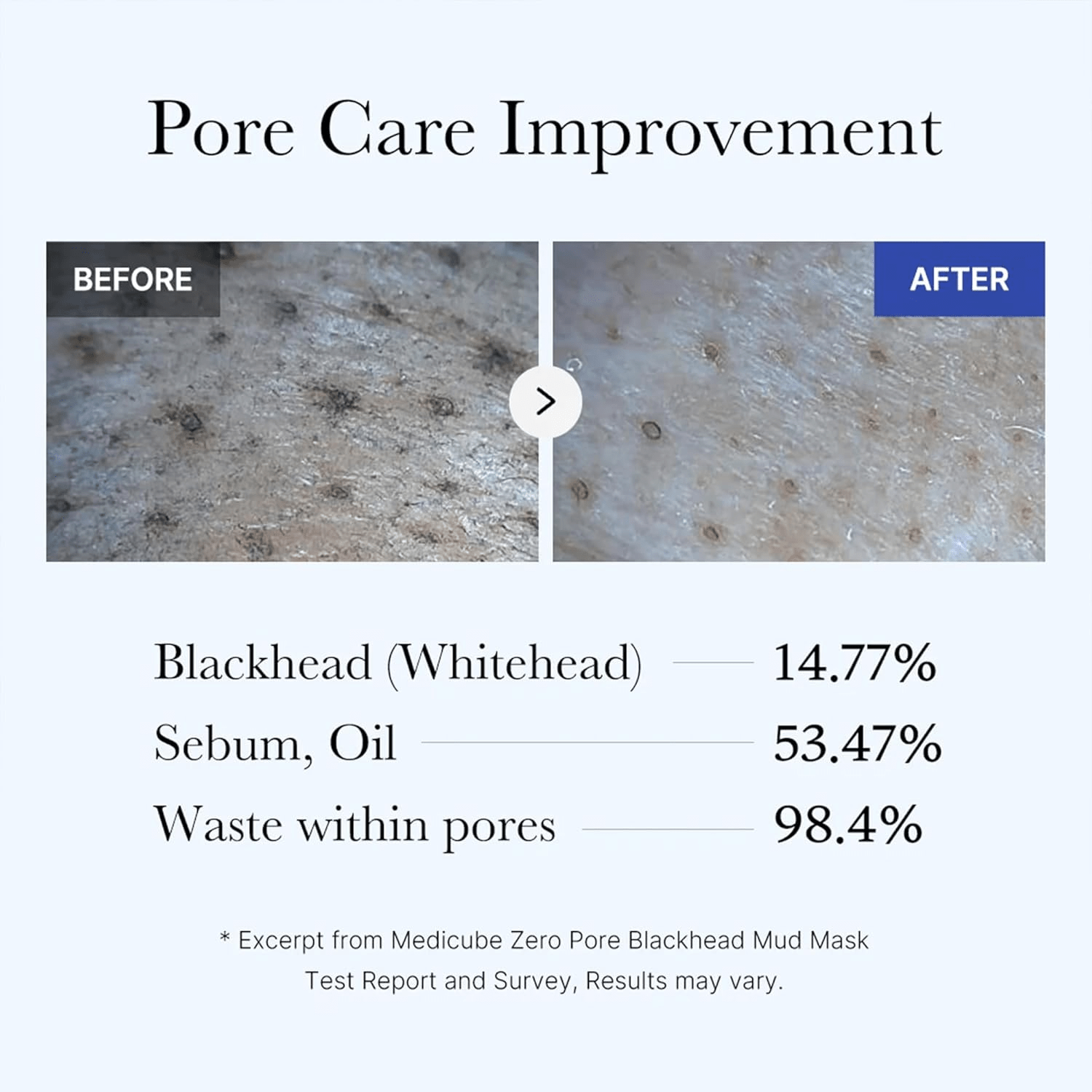 Medicube Zero Pore Blackhead Mud Facial Mask 100g