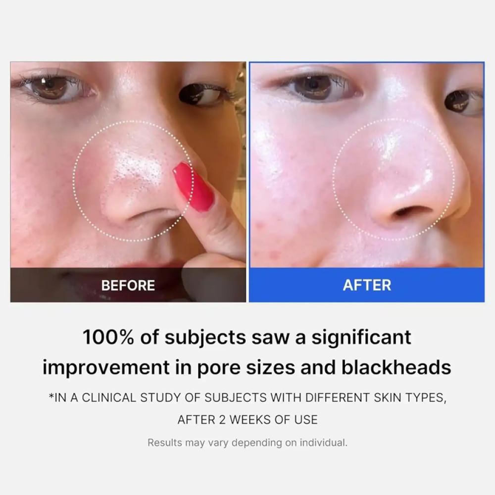 Medicube Zero Pore Pads – Disques Exfoliants & Réducteurs de Pores (70 Pads)